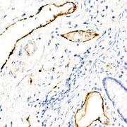 von Willebrand factor (VWF) Rabbit mAb