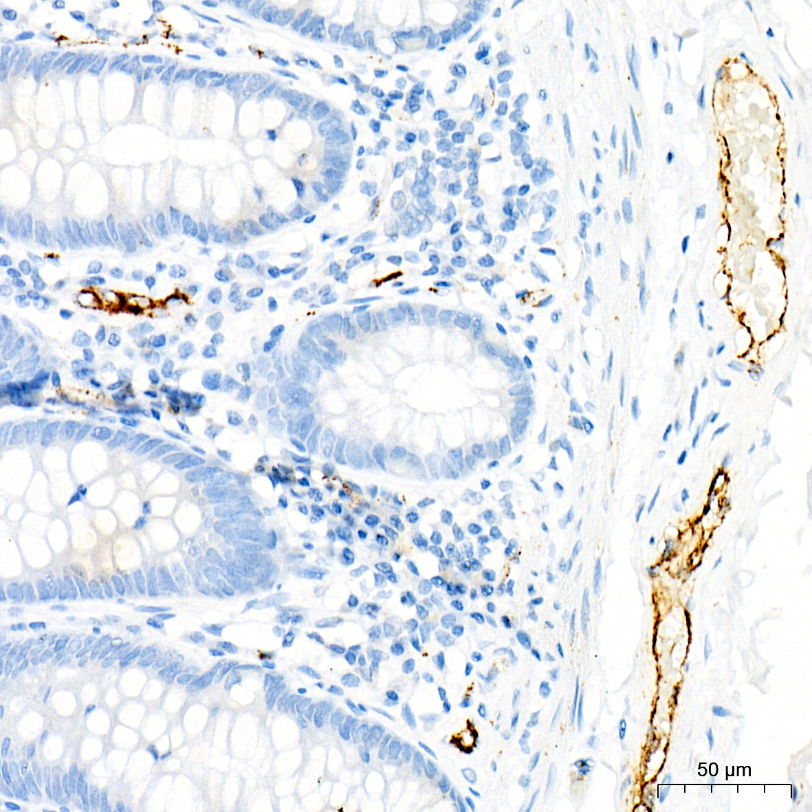 von Willebrand factor (VWF) Rabbit mAb