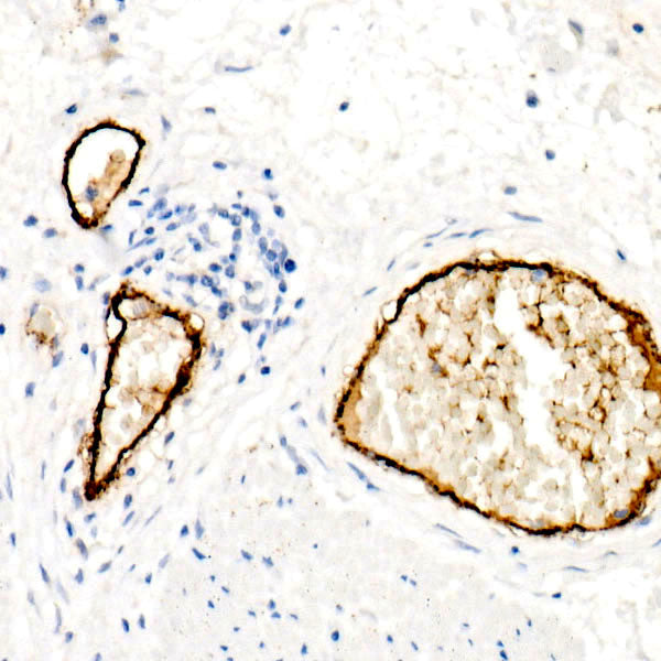 von Willebrand factor (VWF) Rabbit mAb
