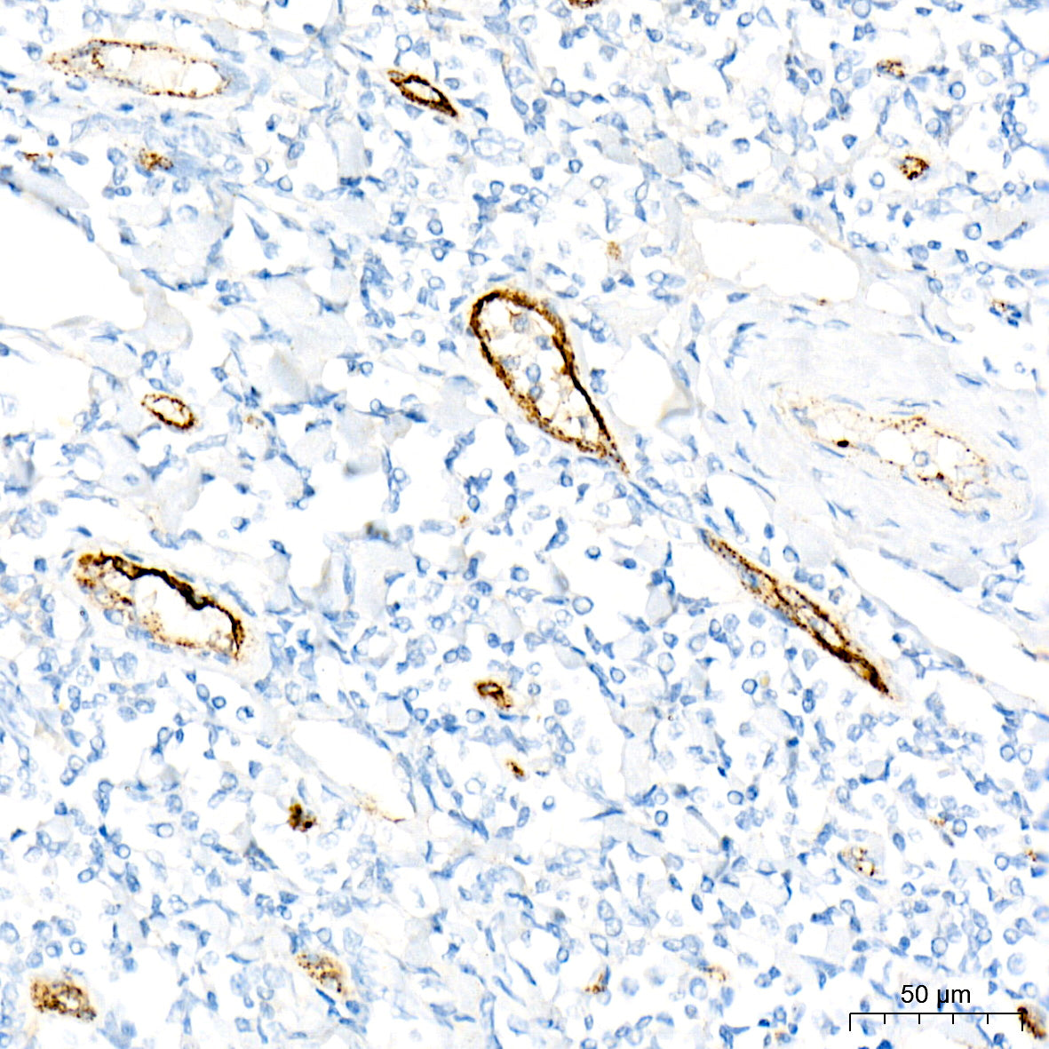 von Willebrand factor (VWF) Rabbit mAb