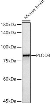 PLOD3 Rabbit mAb