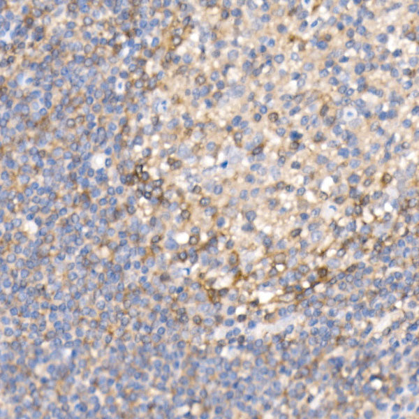 Semaphorin 4D / CD100 Rabbit mAb