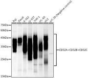 CD32A + CD32B + CD32C Rabbit mAb