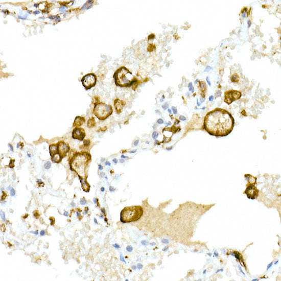 CD32A + CD32B + CD32C Rabbit mAb