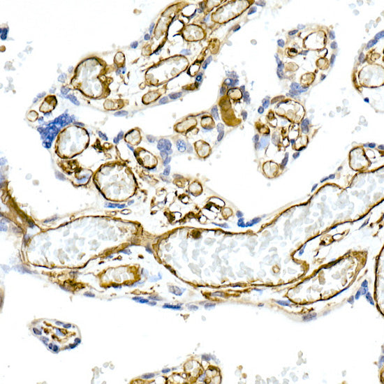 CD32A + CD32B + CD32C Rabbit mAb