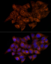 CEP43 Rabbit mAb