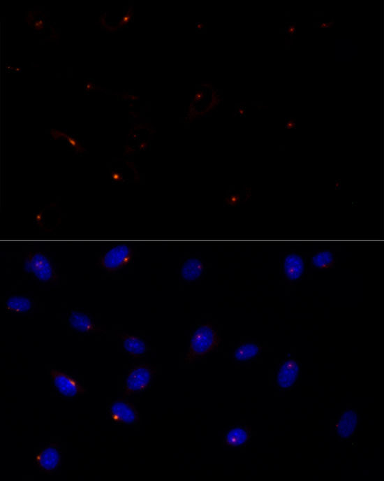 CEP43 Rabbit mAb