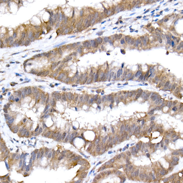 SFT Rabbit mAb