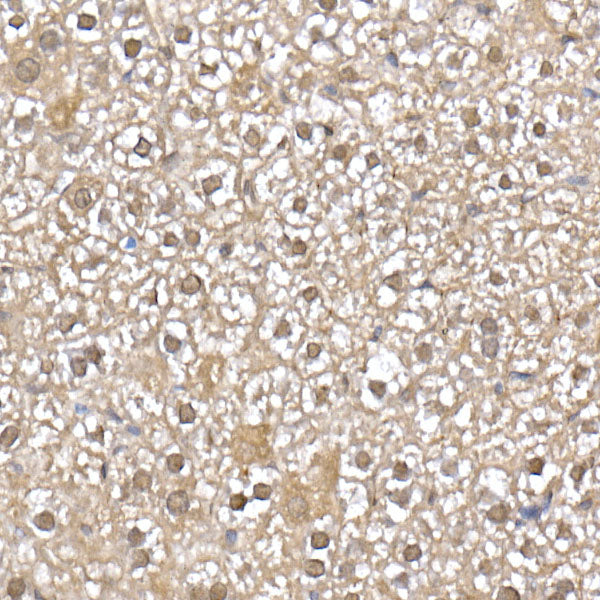 SFT Rabbit mAb