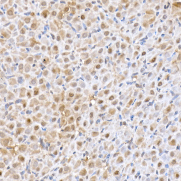SFT Rabbit mAb