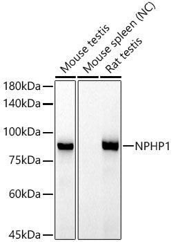 NPHP1 Rabbit mAb