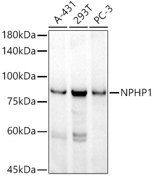 NPHP1 Rabbit mAb