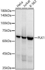 PLK1 Rabbit mAb