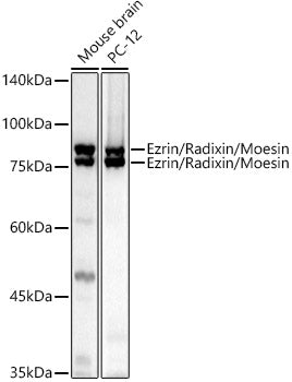Ezrin/Radixin/Moesin Rabbit pAb