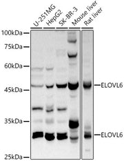 ELOVL6 Rabbit pAb