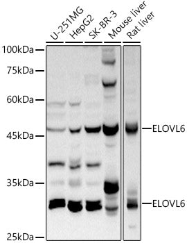 ELOVL6 Rabbit pAb