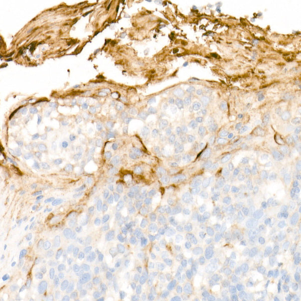 Clusterin Rabbit mAb