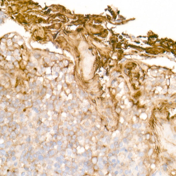Clusterin Rabbit mAb