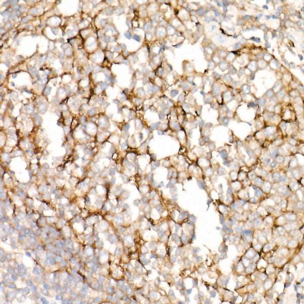 Clusterin Rabbit mAb