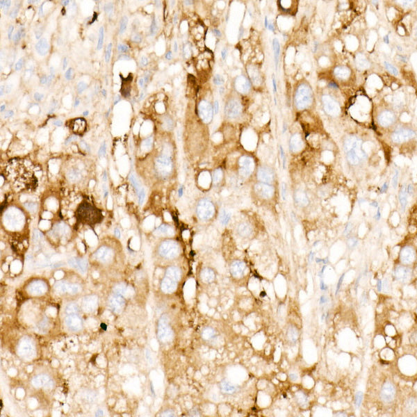 Clusterin Rabbit mAb