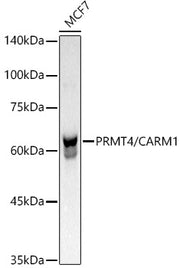 [KO Validated] PRMT4/CARM1 Rabbit mAb