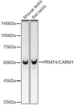 [KO Validated] PRMT4/CARM1 Rabbit mAb