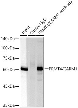 [KO Validated] PRMT4/CARM1 Rabbit mAb