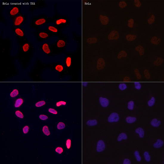 Acetyl-Histone H3-K9 Rabbit mAb