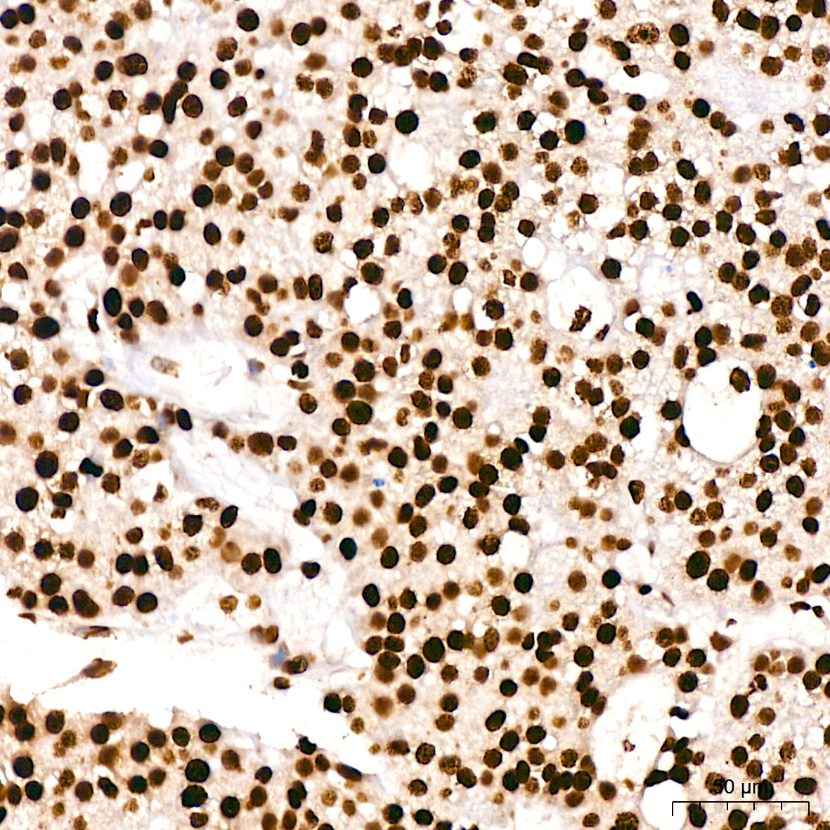 Acetyl-Histone H3-K9 Rabbit mAb