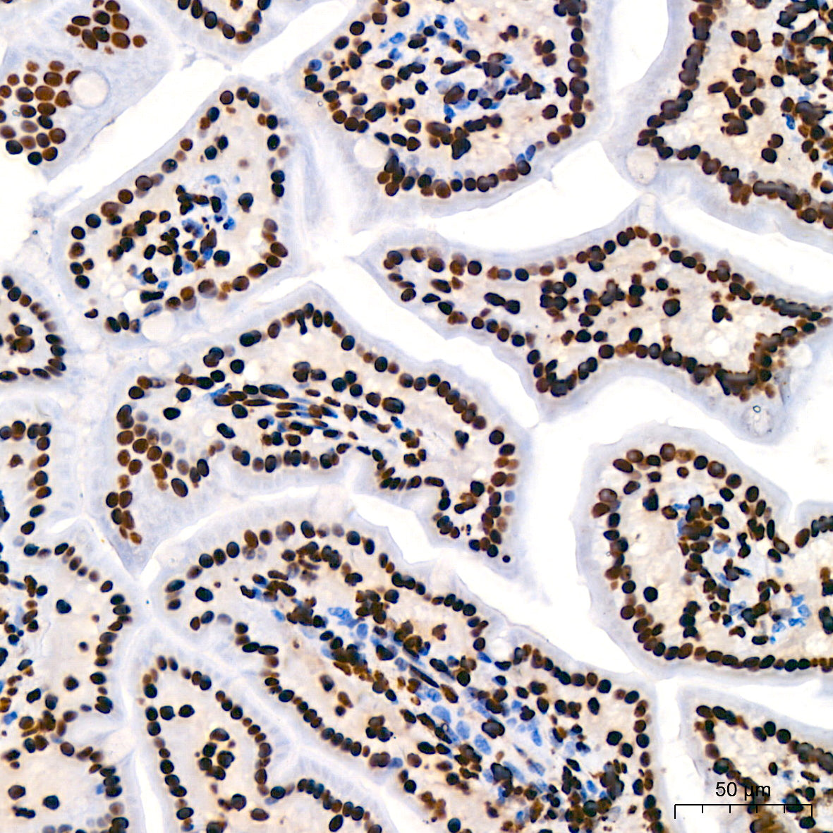 Acetyl-Histone H3-K9 Rabbit mAb