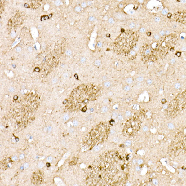 BIN1 Rabbit mAb