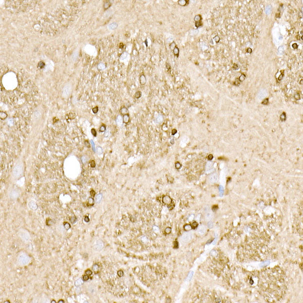 BIN1 Rabbit mAb