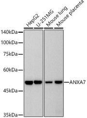 ANXA7 Rabbit mAb