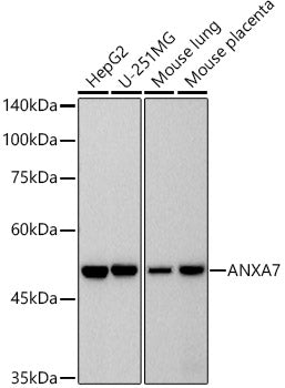ANXA7 Rabbit mAb