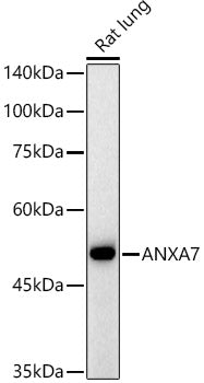 ANXA7 Rabbit mAb