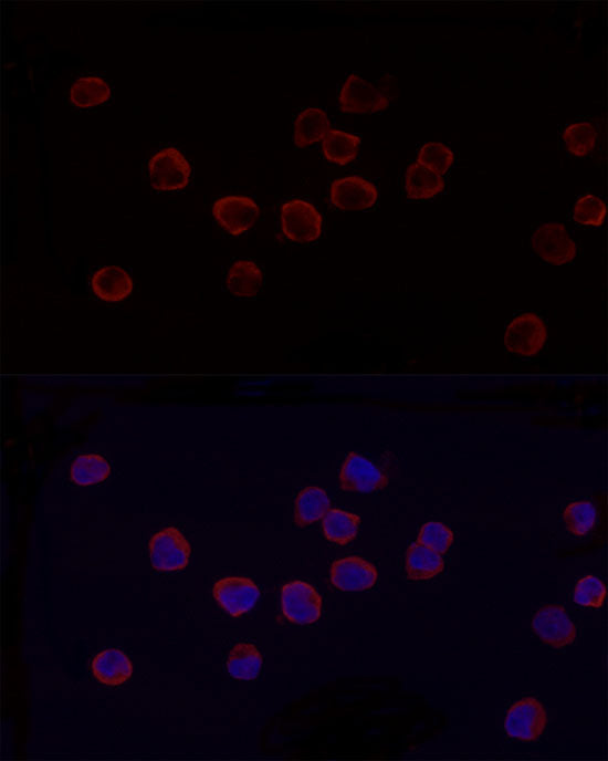 ANXA7 Rabbit mAb