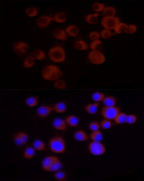 ANXA7 Rabbit mAb