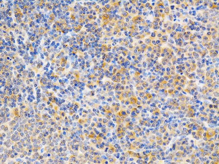 PKC epsilon Rabbit pAb