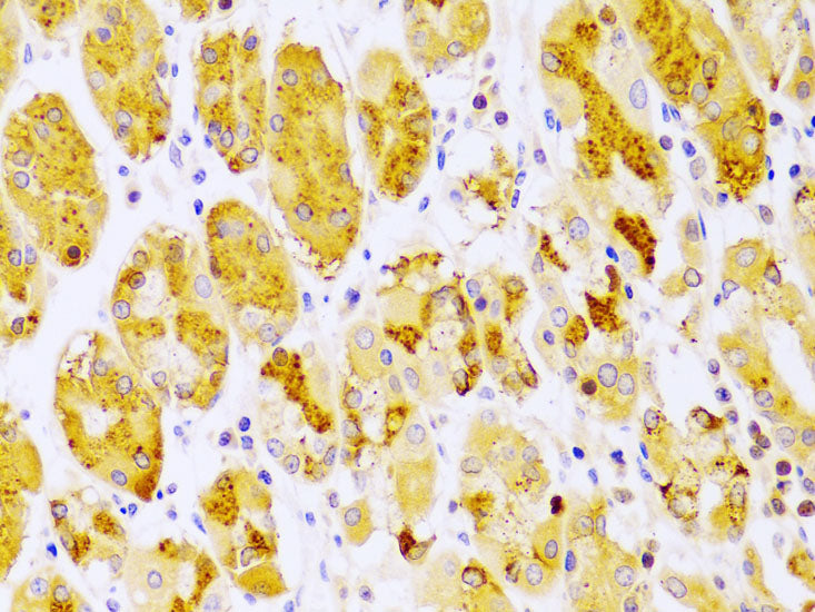 PKC epsilon Rabbit pAb