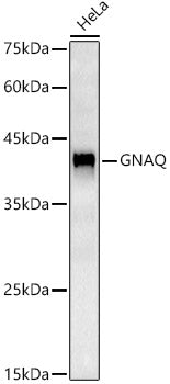 GNAQ Rabbit mAb
