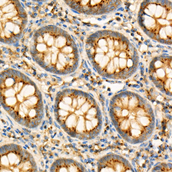 GNAQ Rabbit mAb