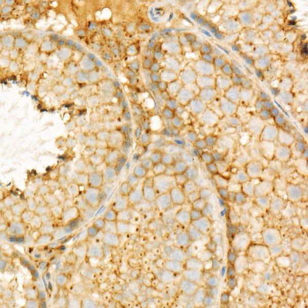 GNAQ Rabbit mAb