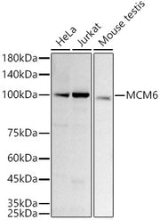[KD Validated] MCM6 Rabbit mAb