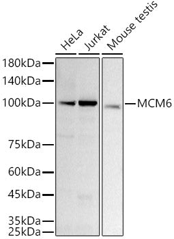 [KD Validated] MCM6 Rabbit mAb