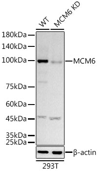 [KD Validated] MCM6 Rabbit mAb