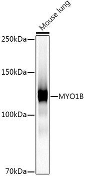 MYO1B Rabbit mAb