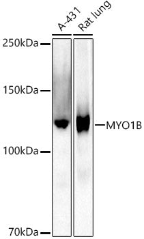 MYO1B Rabbit mAb