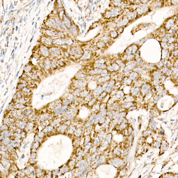 NDUFAB1 Rabbit mAb