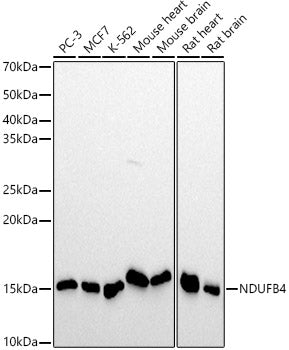 NDUFB4 Rabbit mAb