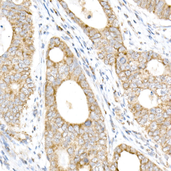 NDUFB4 Rabbit mAb